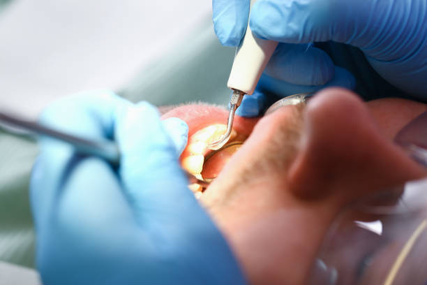 Best Knocked-Out Tooth Emergency  in Topeka, KS