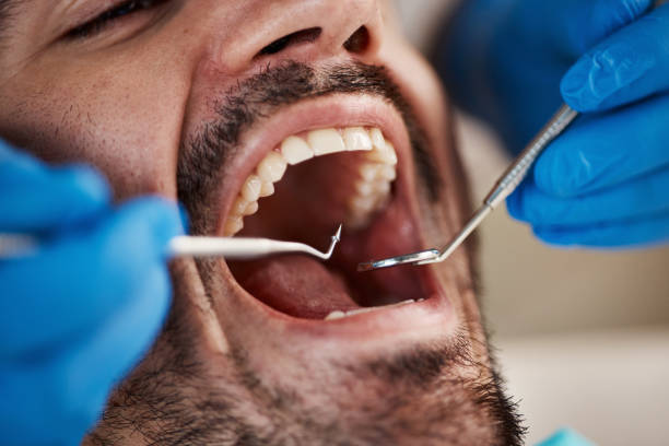 Best Urgent Tooth Repair  in Topeka, KS